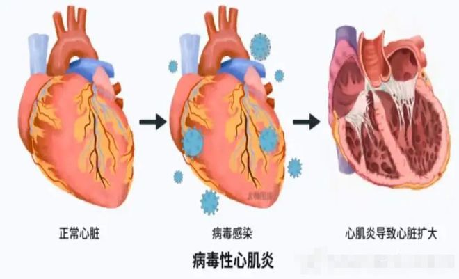 新冠最新症状表现